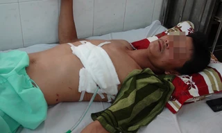 Bệnh nhân Thái đang điều trị tại Bệnh viện Đa khoa Bình Phước. Ảnh: Chế Bắc.