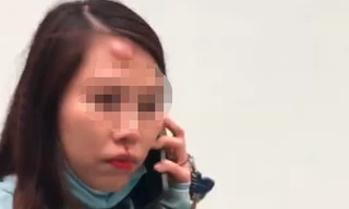 Chị A. bị đánh sưng mặt, chảy máu mũi.