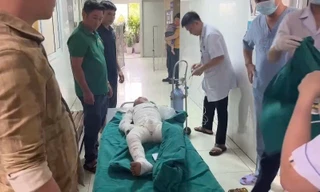 Sử dụng xăng để đốt diệt kiến, hai anh em bỏng nặng