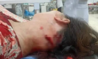 Bà chủ quầy thịt lợn bất ngờ bị người bán hàng rong chém dã man