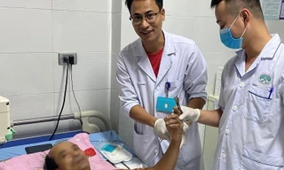 Cánh tay bị đứt lìa được nối thành công