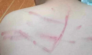 Thanh Hoá: Tạm đình chỉ cô giáo dùng roi tre đánh học trò vì không làm bài tập 