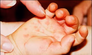 Ảnh minh họa: Internet