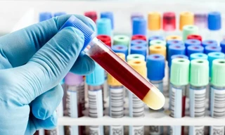 Ảnh minh họa: Internet