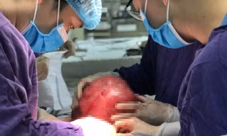 Các bác sĩ BV Ung bướu Hà Nội phẫu thuật cho bệnh nhân mang khối bướu khổng lồ. Ảnh: BV cung cấp