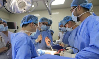 Các bác sĩ thực hiện ca mổ cho bệnh nhân V.