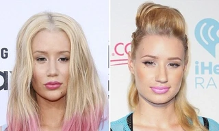 Rapper 9x Iggy Azalea lại gọt cằm, sửa mũi