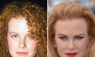 Gương mặt các sao Hollywood sau phẫu thuật