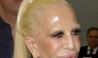 Nhà thiết kế Donatella Versace xấu xí sau thẩm mỹ