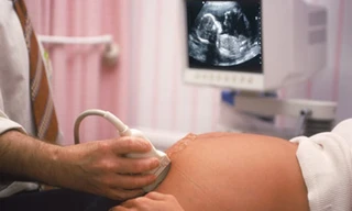 Hơn 40.000 trẻ không được chào đời vì là con gái