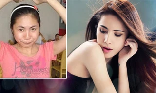 Sao Việt và những hậu quả làm đẹp