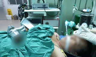 Người phụ nữ bị xay nát cả bàn tay trong máy làm chả cá