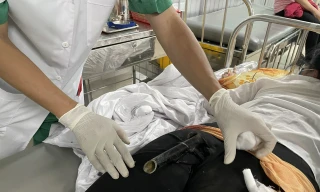 Va chạm giao thông, cô gái bị chân chống xe máy đâm dính vào vùng mông