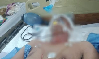 Anh Tấn tử vong do chấn thương sọ não.