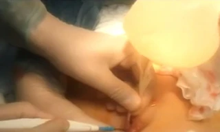 Thẩm mỹ viện không phép hái ra tiền, khách hàng 'lĩnh đủ'