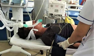 Người đàn ông bị rắn hổ chúa cắn diễn tiến nặng