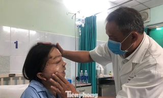 TS.BS Nguyễn Văn Thanh kiểm tra sức khỏe cho cô gái mang khối u 22 năm