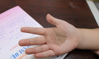 Nếu trẻ có các thương tổn sắc tố trên da, phụ huynh nên đưa trẻ đi khám