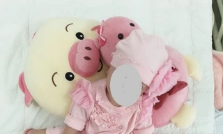 Cặp song sinh dính liền chuẩn bị được phẫu thuật (ảnh: BVCC)