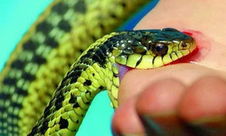 Cần biết cách sơ cứu tại chỗ khi bị rắn cắn
