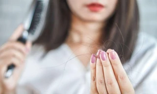 Tóc rụng từng mảng khiến chị em lo lắng