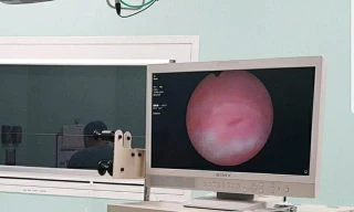 Bác sĩ BV Nhi đồng Thành phố gặp dị vật mắc kẹt cho bệnh nhi (ảnh: BVCC)