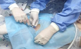 BS cứu sống bệnh nhi suýt chết do mẹ tự cho uống thuốc