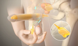 Thiết bị thể hang nhân tạo được xem là cứu cánh cho những bệnh nhân bị rối loạn cương dương khi những giải pháp điều trị thất bại