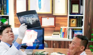 TS.BS Nguyễn Phan Tú Dung điều trị cho "chàng trai mặt quỷ"