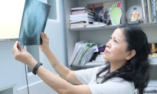 Bổ sung canxi quá đà: Lợi ít hại nhiều