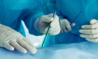 BV Nhi đồng 2 phẫu thuật thành công trường hợp thai trong thai hiếm gặp