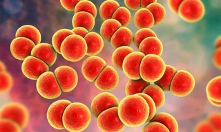 Phát hiện chùm ca mắc bệnh tình dục do nhiễm khuẩn não mô cầu hiếm gặp tại Việt Nam