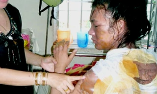 Chồng tạt nước sôi lên vợ vì bị đòi ly dị