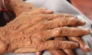 Ảnh minh họa: Internet