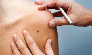 Ảnh minh họa: Internet