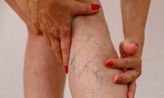 Ảnh minh họa: Internet