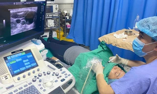 Bệnh nhân u nang tuyến giáp không phải mổ, không nằm viện nhờ phương pháp mới