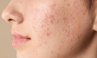 Ảnh minh họa: Internet