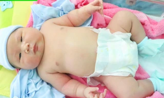 Bé trai chào đời có cân nặng 'khủng' ở Bình Phước