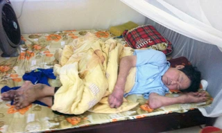 Bệnh gút tấn công người trẻ