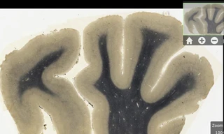 Não của Einstein lên iPad