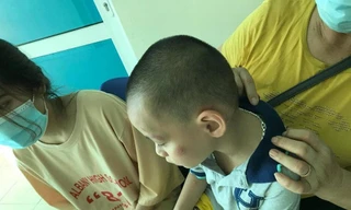 Trong số nhiều người bị chó cắn, có cả em bé bị tấn công vào má, tay rất nguy hiểm. - Ảnh: TL