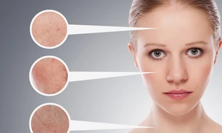 Ảnh minh hoạ: Internet