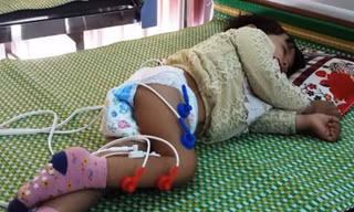 Chuyên gia y tế nhận định cháu bé mắc phải hội chứng Guillain-Barré, hội chứng mà y học rất hạn chế trong việc điều trị. Ảnh: Anh Khắc Tạo chia sẻ trên facebook