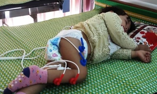 Chuyên gia y tế nhận định cháu bé mắc phải hội chứng Guillain-Barré, hội chứng mà y học rất hạn chế trong việc điều trị. Ảnh: Anh Khắc Tạo chia sẻ trên facebook