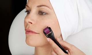 Lăn kim làm đẹp là phương pháp nguy hiểm, có thể nhiễm nhiều căn bệnh chết người. Ảnh minh hoạ: Internet