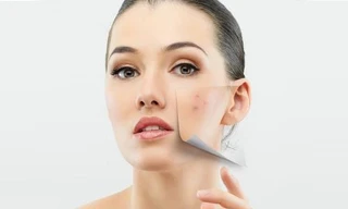 Ảnh minh hoạ: Internet