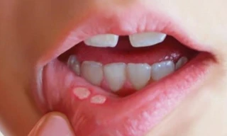 Ảnh minh họa: Internet