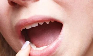 Ảnh minh hoạ: Internet