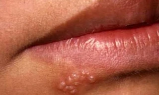 Ảnh minh hoạ: Internet